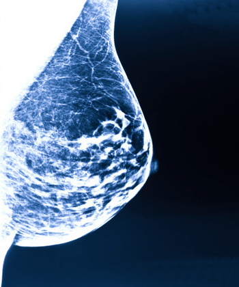 Një virus onkolitik mund të ndihmojë në mposhtjen e kancerit të gjirit trefish negativ